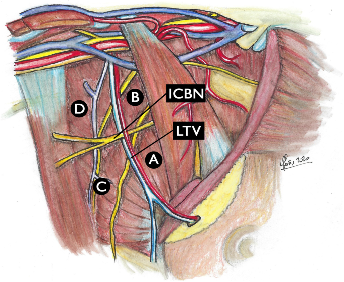 axillary-lymph-node-dissection