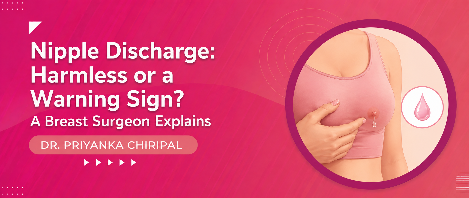 Nipple Discharge: Harmless or a Warning Sign? A Breast Surgeon Explains