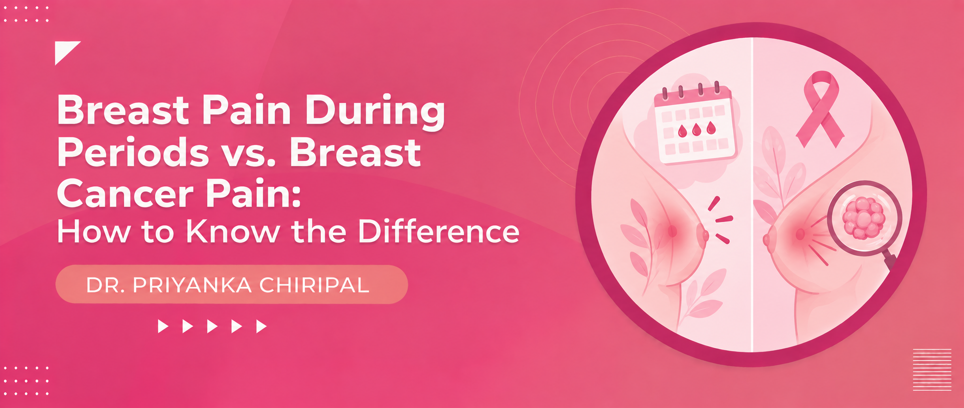 Breast Pain During Periods vs. Breast Cancer Pain: How to Know the Difference