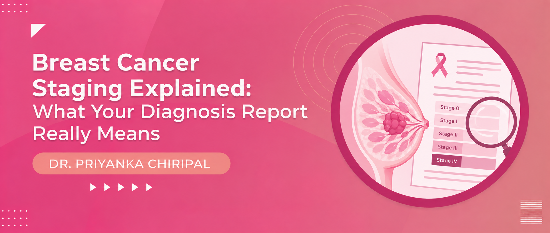 Breast Cancer Staging Explained: What Your Diagnosis Report Really Means