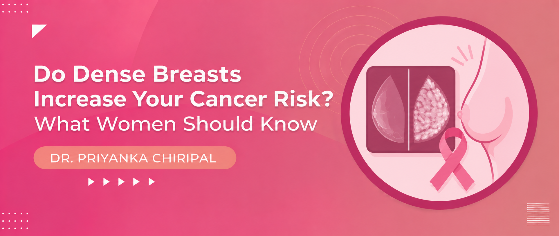 Do Dense Breasts Increase Your Cancer Risk? What Women Should Know